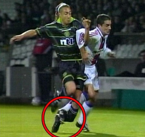 Huyền thoại Henrik Larsson bị gãy chân khi còn khoác áo CLB Celtic